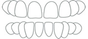 Lücken zwischen den Zähnen · Praxis für Kieferorthopädie · Dr. Sabine Ernst-Strauf